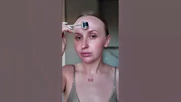 Мезотерапия дома - это реально 🔥 на сайте xmezo.ru скидка 20% на готовые наборы по промокоду ROLLER